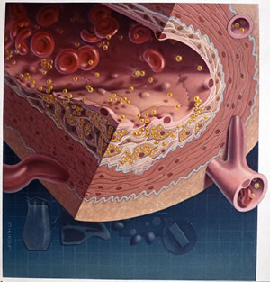 Cholesterol